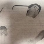 En el hospital despues de la agresion